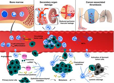 Frontiers  The Significance of Neutrophil Extracellular Traps in