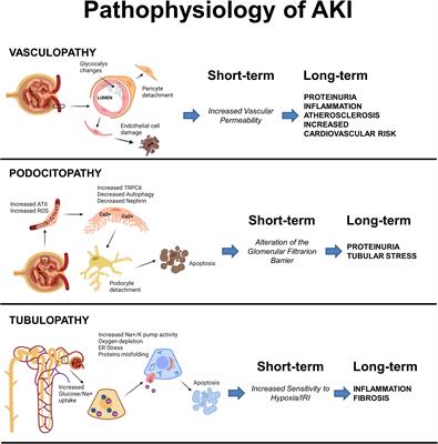 Frontiers | Recent advances in molecular mechanisms of acute kidney