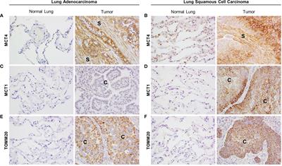 PDF) Abstract A74: Microparticles mediate cross-talk between tumoral and endothelial cells and promote the constitution of an angiocrine pro-metastatic niche through Arf6 up regulation