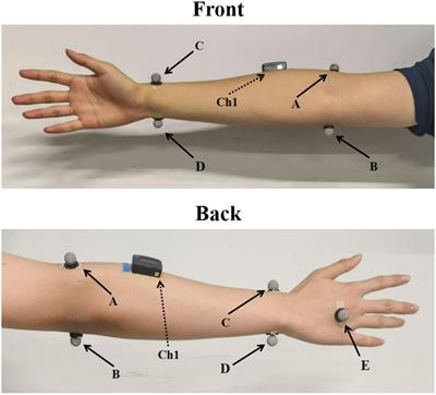 The electromyography (EMG)-driven neuromuscular electrical stimulation