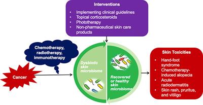 Researchers use skin-colonizing bacteria to create a topical cancer therapy  in mice, News Center