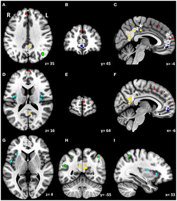 Impacts of Meditation on Brain