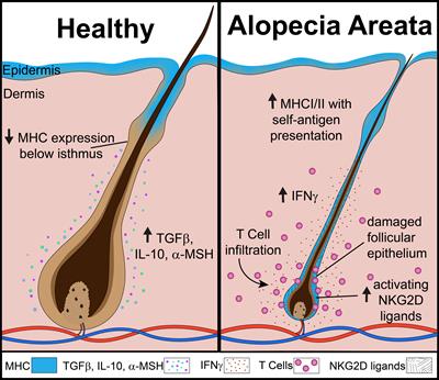 Frontiers | An overview of JAK/STAT pathways and JAK inhibition in alopecia areata Frontiers | An overview of JAK/STAT pathways and JAK inhibition in alopecia areata