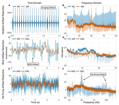 Frontiers  A Channel Rejection Method for Attenuating Motion-Related  Artifacts in EEG Recordings during Walking