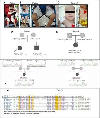 Frontiers Case report: A preterm infant with rubinstein-taybi