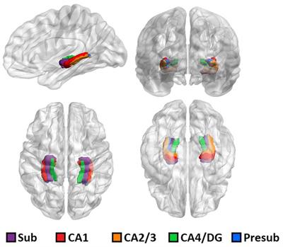 Frontiers  Neural activity in adults with major depressive disorder  differs from that in healthy individuals: A resting-state functional  magnetic resonance imaging study