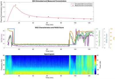 Frontiers  Intrafamilial variability in SLC6A1-related neurodevelopmental  disorders