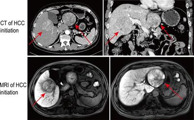 Frontiers A Scientometric Analysis and Visualization Discovery of Enhanced Recovery After Surgery