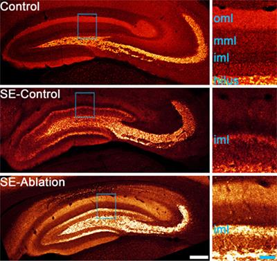 Mossy Fiber Sprouting List Of Frontiers Open Access Articles