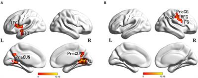 brain spontaneous activity - List of Frontiers' open access articles