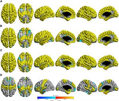 Distinctive Brain Pattern May Underlie >> Frontiers Distinct Brain Regions In Physiological And Pathological Distinctive Brain Pattern May Underlie >> Frontiers Distinct Brain Regions In Physiological And Pathological