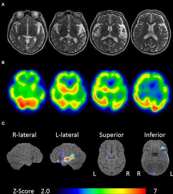auditory agnosia - List of Frontiers' open access articles