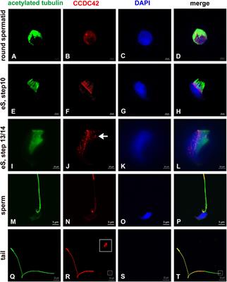 Frontiers In Cell And Developmental Biology Cell Growth