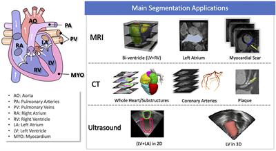 Frontiers | Artificial intelligence in cardiology: Hope for the future and  power for the present