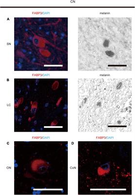 Frontiers Inhibition of α-Synuclein Aggregation and Mature Fibril Disassembling With a Minimalistic Compound, ZPDm
