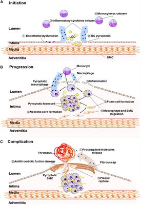 Frontiers  Characteristics and evaluation of atherosclerotic plaques: an  overview of state-of-the-art techniques