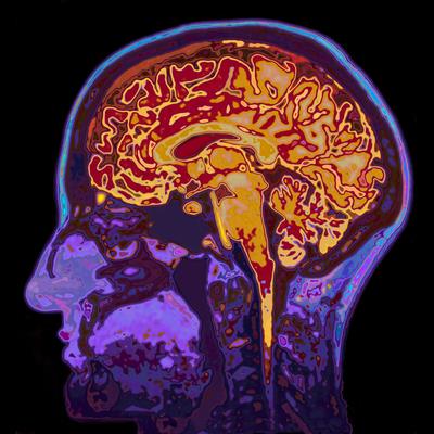 Research Topic Research topic image