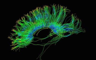 Research Topic Research topic image